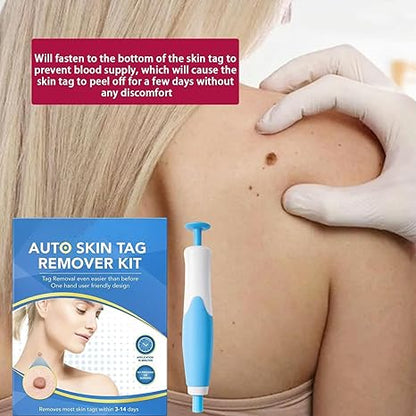 ✨ Acrochordon Skin Tag Remover Kit – 2-in-1 Fast & Painless Solution 🩹💖